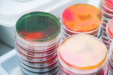 Mikrobiyoloji laboratuvarında biyoloji örnekleriyle çalışma masası.