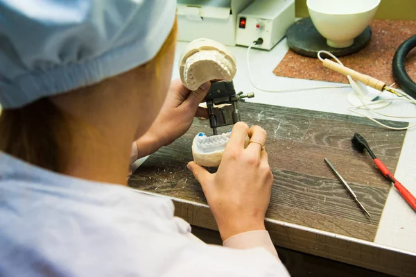 Dentist makes a dental implant prosthesis made of plaster cast — Stock Photo, Image