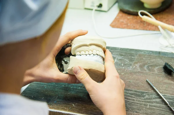 Tandläkaren gör en dentala implantat protes gjorda av gips cast — Stockfoto