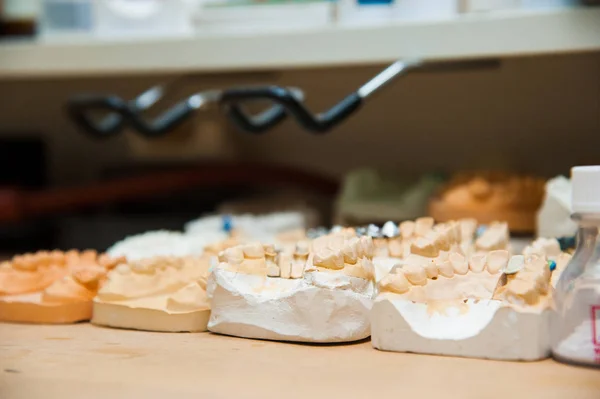 Стоматолог делает протез зубного импланта из гипсового литья — стоковое фото
