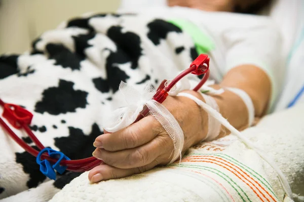 Patienten Övervakas Med Elektronisk Blodtrycksmätare Dialysbehandling Avancerad Dialysutrustning Sjukhus — Stockfoto