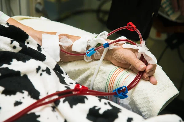 Patienten Övervakas Med Elektronisk Blodtrycksmätare Dialysbehandling Avancerad Dialysutrustning Sjukhus — Stockfoto