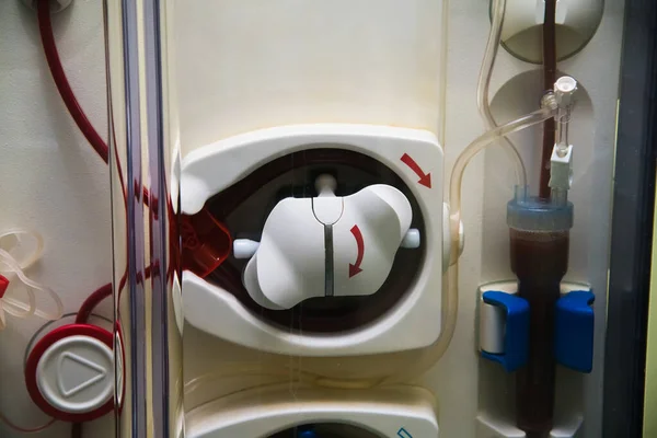 Beteget Elektronikus Vérnyomásmérővel Monitorozták Dialízis Alatt Speciális Dialízis Berendezések Kórházban — Stock Fotó