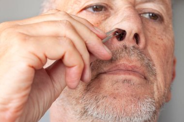 Tıraşsız kıdemli bir adam cımbızla burun kılı büzüyor. Resmi kapat. 