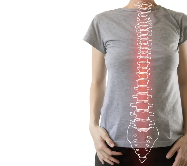 Sakit di tulang belakang, seorang wanita dengan sakit punggung — Stok Foto