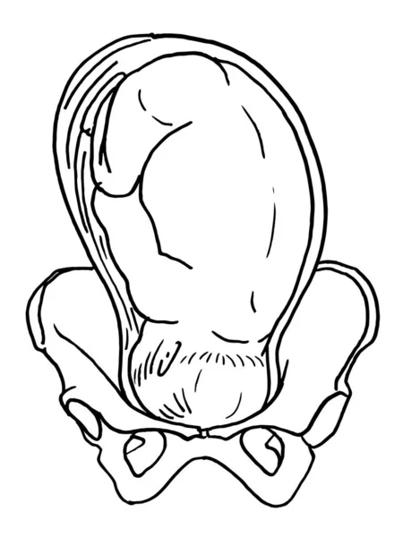 Контурный Векторный Рисунок Человеческого Эмбриона Медицинский Дизайн Редактируемый Шаблон — стоковый вектор