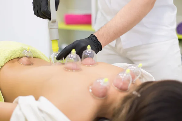 Ung kvinna om på massage bordet och gör hijama behandling — Stockfoto