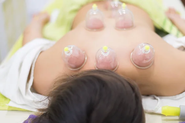 Young woman laying down at the massage table and doing hijama treatment — Stock Photo, Image