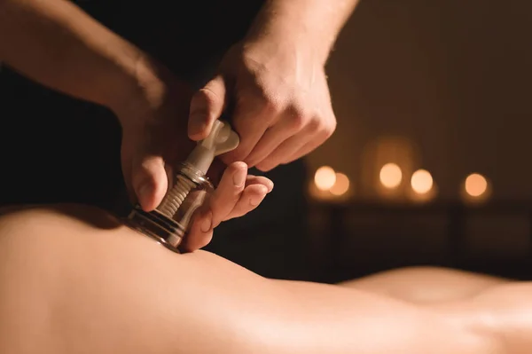 Close-up Cosmetologia de hardware. Procedimento de massagem a vácuo. Mãos masculinas instalam bancos de vácuo. Close-up de tratamento anti-celulite de uma jovem mulher — Fotografia de Stock