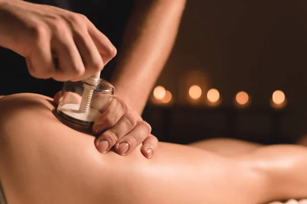 Närbild hårdvara kosmetologi. Vakuum massage förfarande. Manliga händer installera vakuum banker. Närbild av anti-celluliter behandling av en ung kvinna — Stockfoto