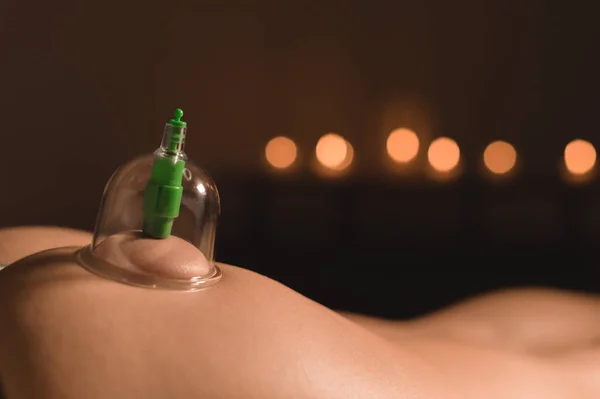 Close-up of wet caps for vacuum massage installed on the buttock of a young girl on the background of burning candles in a dark room — Stock Photo, Image