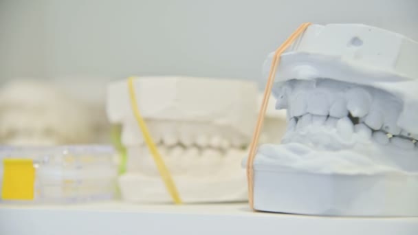 Modelo de yeso dental moldeado de mandíbula dental humana. Prótesis de laboratorio. Primer plano — Vídeos de Stock