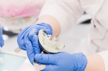 Bir diş hekimi diş bir döküm yapar. Doktorlar eller Close-Up