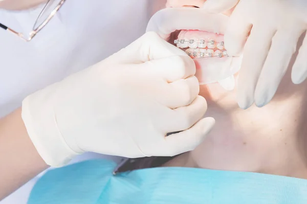 Macro primo piano estremo di bocca umana femminile aperta che mostra bretelle in acciaio inossidabile. Ispezione dell'installazione e rimozione dell'apparecchio da parte del dentista — Foto Stock