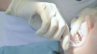 Yaşında Bayan hasta ağız boşluğu inceleyerek bir kadın dişçi close-up. Yüksek anahtar profesyonel iş bir dişçi diş Kliniği