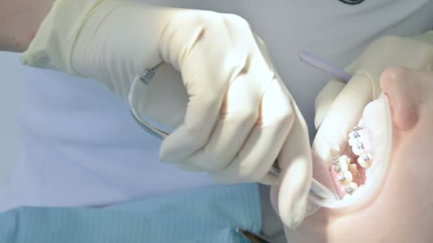 Primer plano de una mujer dentista examinando la cavidad oral de una paciente femenina a la edad. Trabajo profesional clave de un dentista en la clínica dental — Vídeo de stock