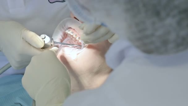 Közeli kép: egy nő fogorvos vizsgálata a szájüregben egy női pácienssel korában. Magas kulcs szakmai munkájának a fogorvos-fogászati klinika — Stock videók