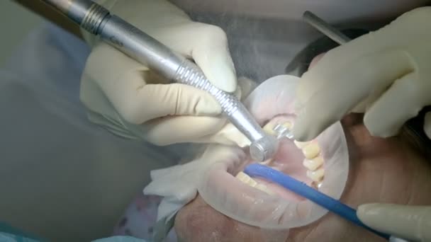 Dentista femenina con un asistente examina la boca de los pacientes de un hombre de edad avanzada. Trabajo profesional clave de un dentista en la clínica dental — Vídeos de Stock