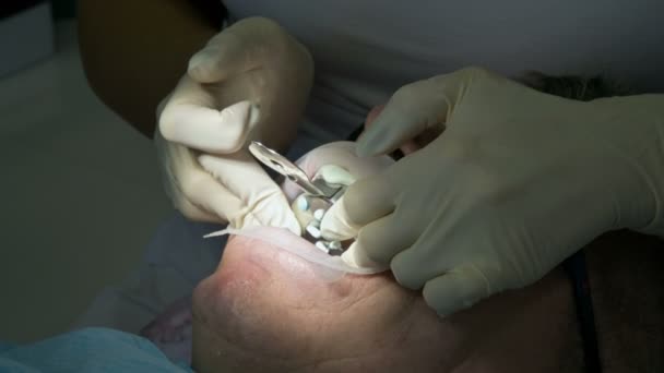 Dentista femenina con un asistente examina la boca de los pacientes de un hombre de edad avanzada. Trabajo profesional clave de un dentista en la clínica dental — Vídeos de Stock