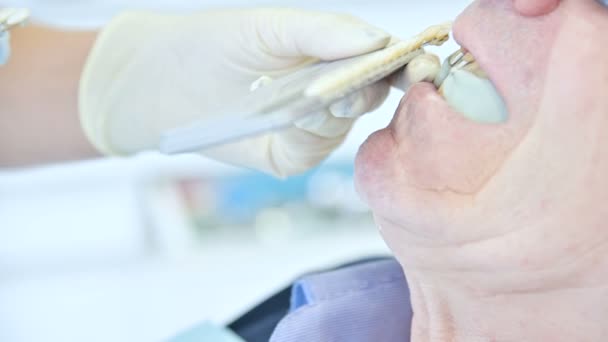Крупным планом стоматолог выбирает цвет для пациента, чтобы создать протез. Стоматология в 4k — стоковое видео