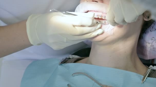 Közeli kép: egy nő fogorvos vizsgálata a szájüregben egy női pácienssel korában. Magas kulcs szakmai munkájának a fogorvos-fogászati klinika — Stock videók