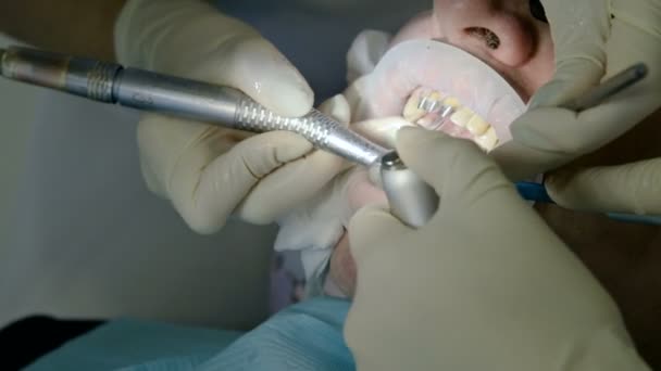 Dentista femenina con un asistente examina la boca de los pacientes de un hombre de edad avanzada. Trabajo profesional clave de un dentista en la clínica dental — Vídeos de Stock