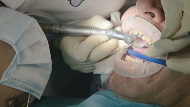 Женщина-дантист с ассистентом осматривает рот пациента пожилого мужчины. Высокая профессиональная работа стоматолога в стоматологической клинике — стоковое видео