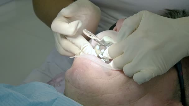 Жінка-стоматолог з асистентом оглядає рот пацієнтки чоловіка літнього чоловіка. Висока професійна робота стоматолога в стоматологічній клініці — стокове відео