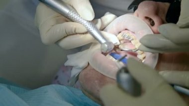 Asistan ile kadın diş hekimi bir adam yaşlı bir adamın hasta ağız inceliyor. Yüksek anahtar profesyonel iş bir dişçi diş Kliniği