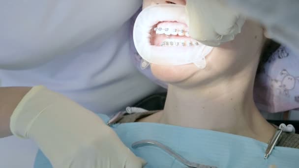 Yaşında Bayan hasta ağız boşluğu inceleyerek bir kadın dişçi close-up. Yüksek anahtar profesyonel iş bir dişçi diş Kliniği — Stok video