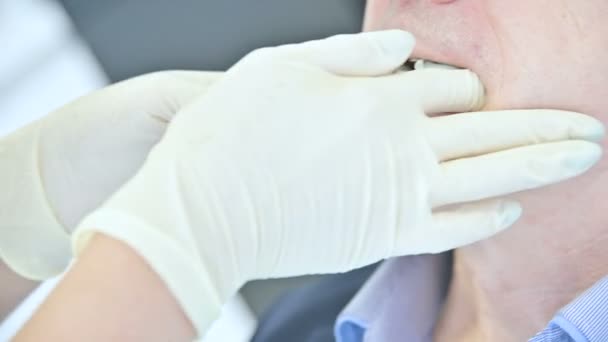 Nahaufnahme einer Zahnärztin, die einen Polymerabguss des Mundes eines Patienten von einem Mann im Alter herstellt. hohe fachliche Kompetenz eines Zahnarztes in der Zahnklinik — Stockvideo