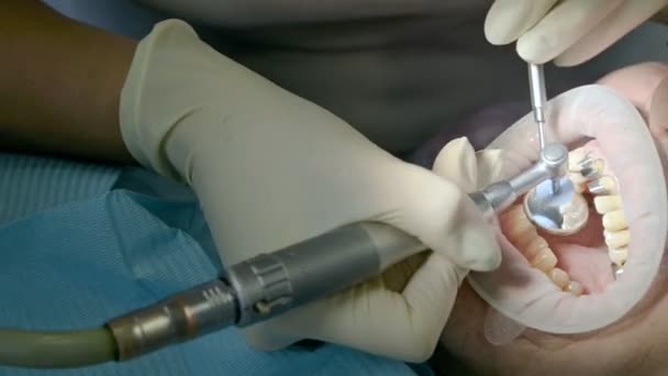 Female dentist with an assistant examines the patients mouth of a man of an aged man. High key professional work of a dentist in the dental clinic — Stock Video