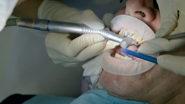 Női fogorvos egy asszisztens megvizsgálja a beteg száj egy férfi egy idős ember. Magas kulcs szakmai munkájának a fogorvos-fogászati klinika — Stock videók
