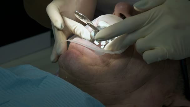 Medicul dentist de sex feminin cu un asistent examinează gura pacienților unui bărbat de vârstă. Lucrarea profesională importantă a unui dentist în clinica stomatologică — Videoclip de stoc