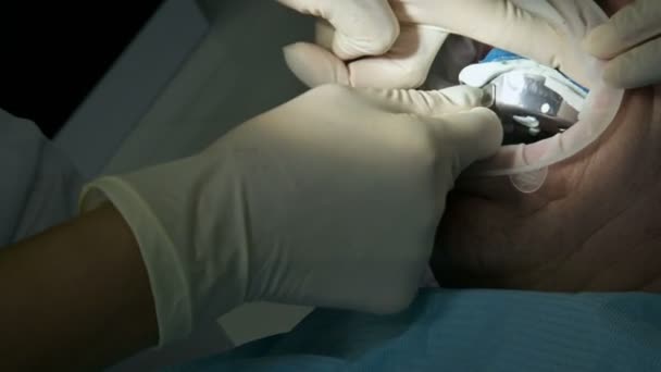 Medicul dentist de sex feminin cu un asistent examinează gura pacienților unui bărbat de vârstă. Lucrarea profesională importantă a unui dentist în clinica stomatologică — Videoclip de stoc