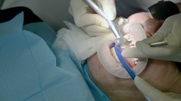 Female dentist with an assistant examines the patients mouth of a man of an aged man. High key professional work of a dentist in the dental clinic — Stock Video