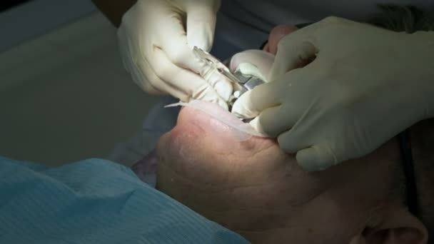Vrouwelijk tandarts met een assistent onderzoekt de monding van de patiënten van een man van een jaar oud man. Hoge professionele sleutelwerk van een tandarts in de tandheelkundige kliniek — Stockvideo