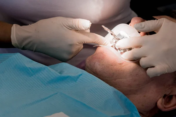 Γυναίκα οδοντίατρος με βοηθός εξετάζει το στόμα ένας άνθρωπος ενός άνδρα ηλικίας ασθενείς. Υψηλή βασική επαγγελματική εργασία οδοντιάτρου σε οδοντιατρείο — Φωτογραφία Αρχείου