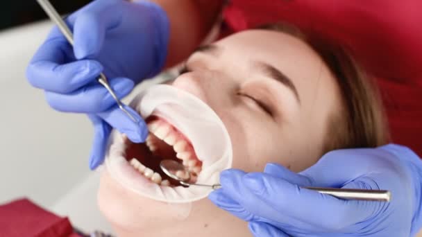 A close-up of the girls face is examined by a dental examiner with his mouth open and a napkin and eyes closed. Dentist hands with inspection tools — Stock Video