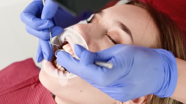Eine Nahaufnahme des Mädchengesichts wird von einem Zahnarzt mit offenem Mund, Serviette und geschlossenen Augen untersucht. Zahnarzthände mit Kontrollwerkzeugen — Stockvideo