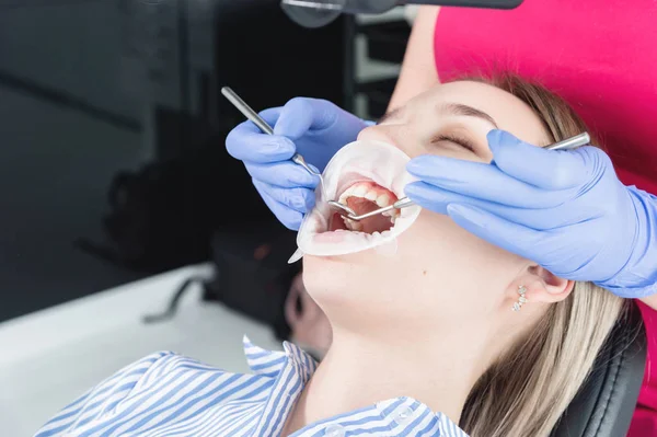 Ένα κοντινό από το πρόσωπο των κοριτσιών εξετάζεται από έναν οδοντίατρο με το στόμα ανοιχτό και μια χαρτοπετσέτα και τα μάτια κλειστά. Χέρια οδοντίατρου με εργαλεία επιθεώρησης — Φωτογραφία Αρχείου