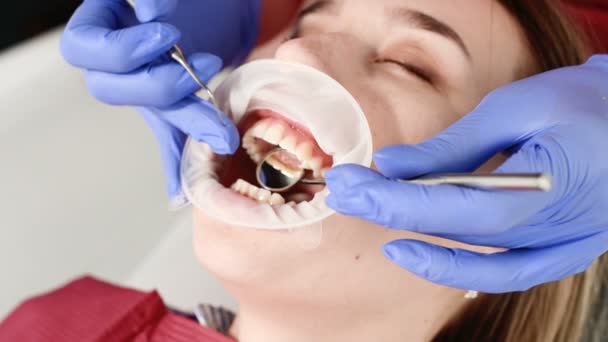 En närbild av flickorna ansikte undersöks av en tand examinator med munnen öppen och en servett och slutna ögon. Tandläkare händer med inspektionsverktyg — Stockvideo