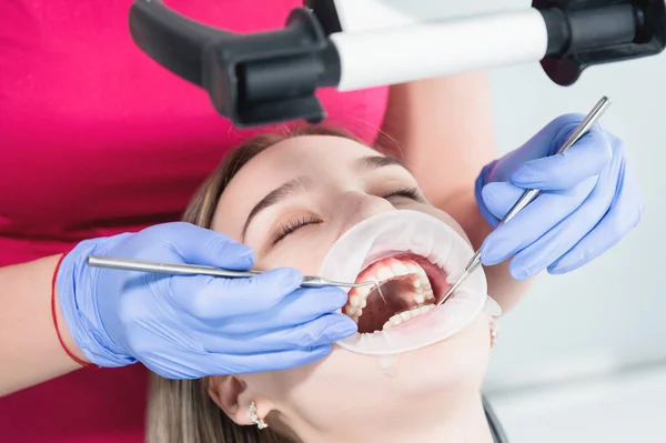 Ένα κοντινό από το πρόσωπο των κοριτσιών εξετάζεται από έναν οδοντίατρο με το στόμα ανοιχτό και μια χαρτοπετσέτα και τα μάτια κλειστά. Χέρια οδοντίατρου με εργαλεία επιθεώρησης — Φωτογραφία Αρχείου