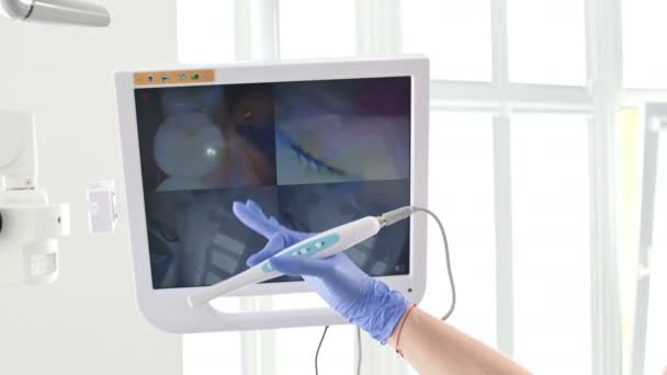 Professionell kvinnlig tandläkare visar sin hand på skärmen av en ung flicka i en tandläkarstol med hjälp av en intraoral stamotologisk videokamera med LED-bakgrundsbelysning — Stockvideo