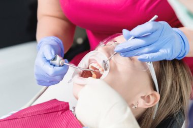 Diş hekimi sandalyesinde yakın çekim genç bir kız temizlik ve boyutlandırma ile parantez çıkardıktan sonra rutin bir tanı uğrar. Yaşamda ve klinikte stamatoloji