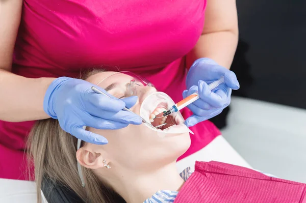 Κοντινό-up ένα νεαρό κορίτσι σε μια καρέκλα οδοντιάτρων υποβάλλεται σε διάγνωση ρουτίνας μετά την αφαίρεση σιδεράκια με τον καθαρισμό και το μέγεθος. Η σταμαμολογία στη ζωή και στην κλινική — Φωτογραφία Αρχείου