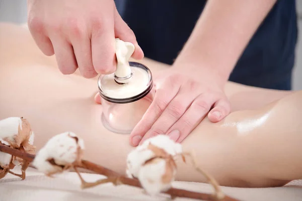 Close-up of a male physiotherapist massage therapist doing a vacuum can massage to a young girl on her hips next to cotton flowers. Tenderness and attention to health. Cellulite treatments. — Stock Photo, Image