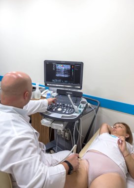 Odessa, Ukrayna - 29 Temmuz 2018: Kadın muayene damarların ultrason sensör modern teknoloji Kliniği üzerinde uğrar. Damarlar ve doppler incelenmesi monitör durumu