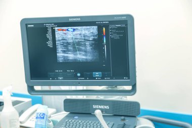Odessa, Ukrayna - 29 Temmuz 2018: Kadın muayene damarların ultrason sensör modern teknoloji Kliniği üzerinde uğrar. Damarlar ve doppler incelenmesi monitör durumu