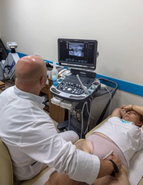 Odessa, Ukrayna - 29 Temmuz 2018: Kadın muayene damarların ultrason sensör modern teknoloji Kliniği üzerinde uğrar. Damarlar ve doppler incelenmesi monitör durumu